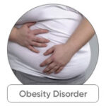 obesity-disorder_180x
